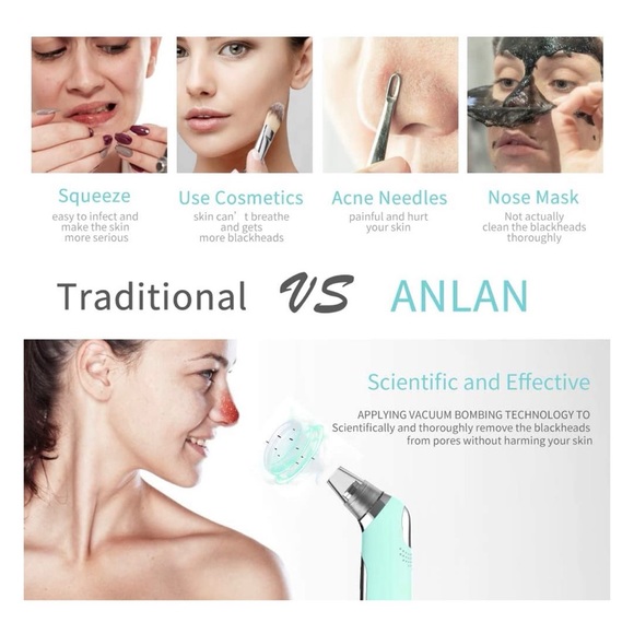 BRAND NEW Blackhead Remover T Zone Pore Vacuum Cleaner - Picture 4 of 9